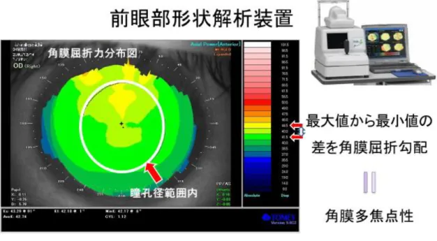 図 3  角膜多焦点性解析法． 
