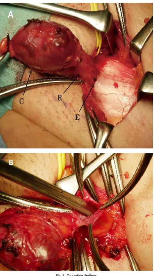 Fig. 3  Operative findings
