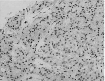 Fig.　2. Images of appendix cancer before oral UFT / LV in November of 2005.  a: A colonoscopy revealed  that the colon was pressed from the outside, but the cancer was not exposed
