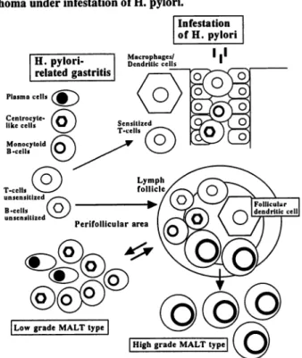 Figure 1. A hypothesis of pathogenesis of gastric MALT type lymphoma under infestation of H