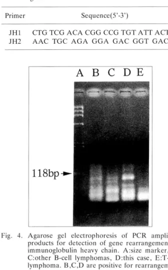Table 1. Primers specific to immunoglobulin heavy chain