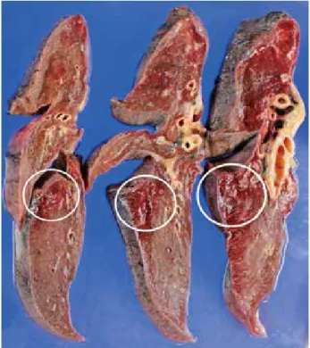 Figure 6　Right lung excised at autopsy