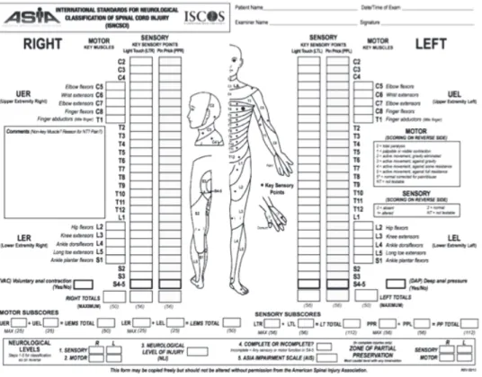 Table 1 ASIA Impairment Scale  A ―Complete：No motor or sensory function in the lowest sacral segment.