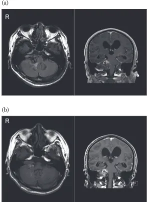Figure 1: Magnetic resonance (MR) images