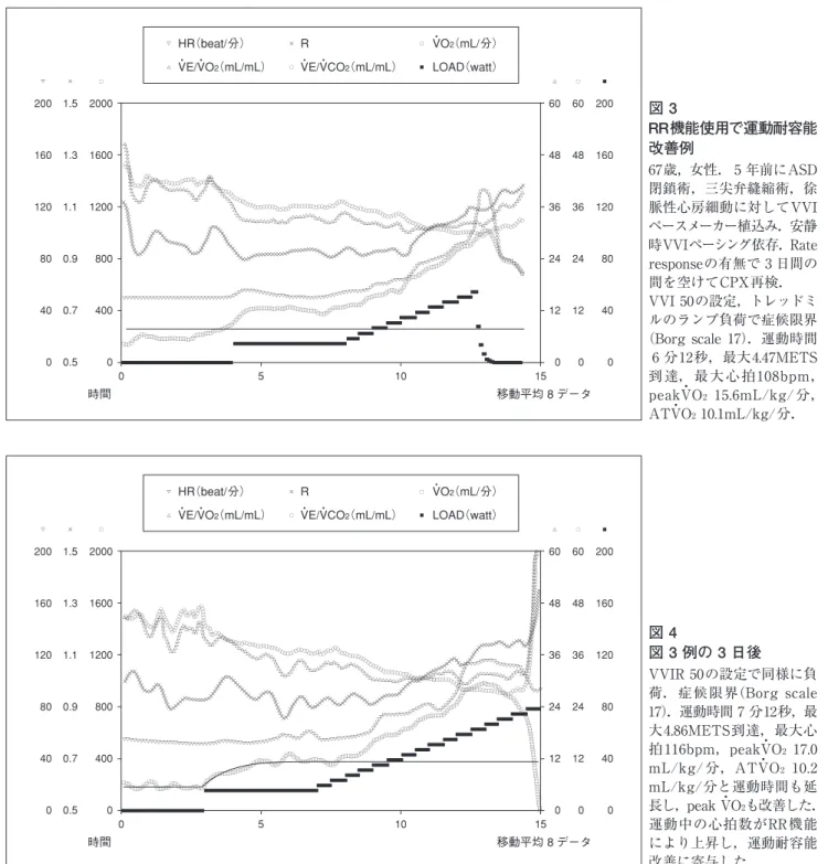 図 3　 RR機能使用で運動耐容能 改善例 67歳，女性． 5 年前にASD 閉鎖術，三尖弁縫縮術，徐 脈性心房細動に対してVVI ペースメーカー植込み．安静 時VVIペーシング依存．Rate  responseの有無で 3 日間の 間を空けてCPX再検． VVI 50の設定，トレッドミ ルのランプ負荷で症候限界 （Borg scale 17）．運動時間 6 分12秒，最大4.47METS 到 達， 最 大 心 拍108bpm， peakV4 O 2   15.6mL/kg/ 分， ATV4 O 2  10