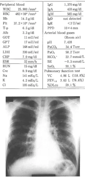 Fig.  1  Chest  X-ray  film  on  admission  shows  a  small  granular  shadow  and  ground-glass  shadows  in  both  middle  lung  fields.