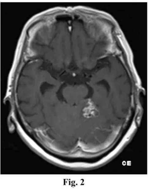 Fig. 2 Fig. 1 