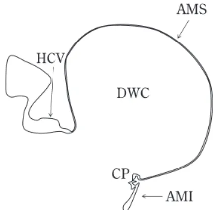Fig. 8   Schematic drawing of the Dandy Walker   The Dandy Walker cyst（DWC）is characterized by cyst expansion of the primitive fourth ventricular roof due  to persistence of the area membranacea superior