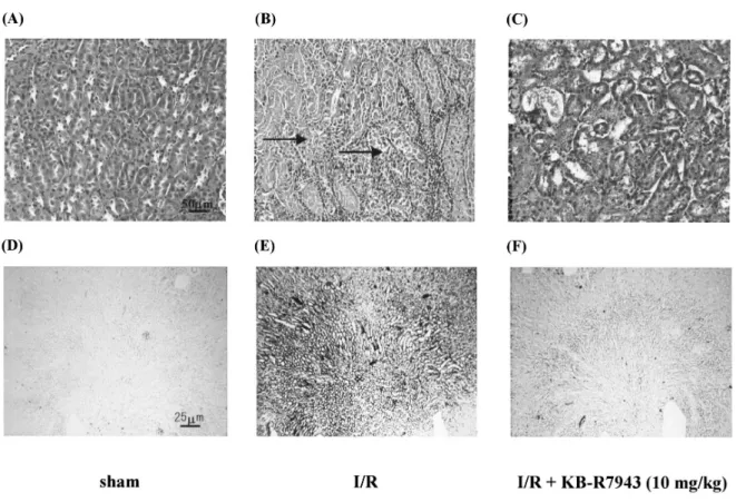 Figure 3. Light microscopy of outer zone outer stripe of the medulla of the kidney of ARF mice treated  with vehicle (B, untreated) and KB-R7943 (C, 10 mg/kg) at 48 h after I/R, and sham mice  (A)