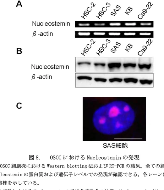 図 8.   OSCC における Nucleostemin の発現 