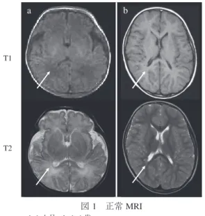 図 3 先天性大脳白質形成不全症所見を呈する MRI 画像から診断へのフローチャート