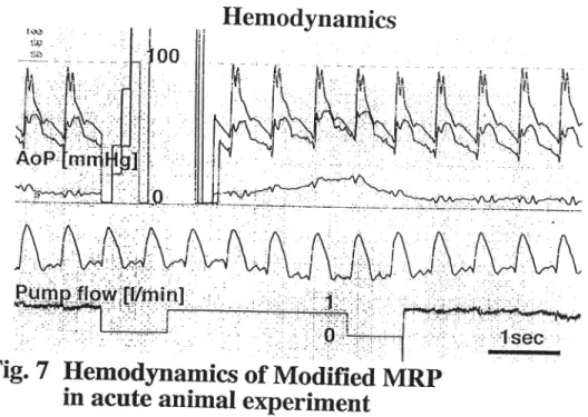 Fig. 7  Hemodynamics  of Modified MRP