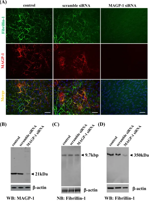 Fig. 3. Effect of MAGP-1 suppression on oxytalan fiber formation. (A) Human non-pigmented ciliary epithelial cells were transiently trans- trans-fected with 200 nM scrambled siRNA for MAGP-1 (middle column), or with 200 nM siRNA for MAGP-1 (right column)