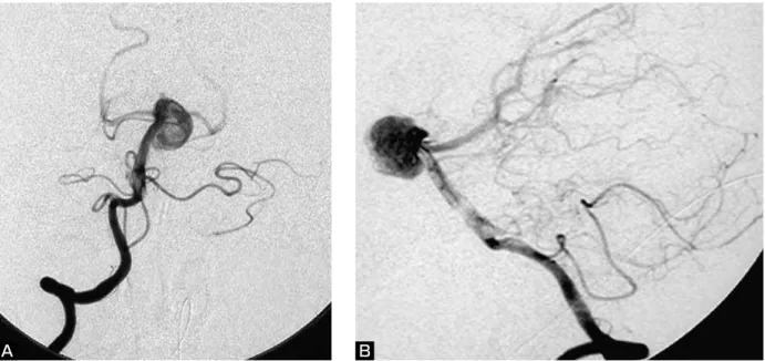 Fig. 3   Illustrations show the preoperative working angle. The procedure are as follows:
