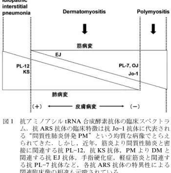 図 1 抗アミノアシル tRNA 合成酵素抗体の臨床スペクトラ ム．抗 ARS 抗体の臨床特徴は抗 Jo1 抗体に代表され る“間質性肺炎併発 PM”という均質な病像でとらえ られてきた．しかし，近年，筋炎より間質性肺炎と密 接に関連する抗 PL12，抗 KS 抗体，PM より DM と 関連する抗 EJ 抗体，手指硬化症，軽症筋炎と関連す る抗 PL7 抗体など，各抗 ARS 抗体の特異性による 関連臨床像の相違も示唆されている．コ ド ン を 持 つ tRNA を 特 異 的 に 免 疫 沈 降 