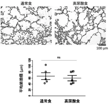 Fig. エラスターゼ噴霧 週間後の肺胞拡大に及ぼす高尿酸食の影響 HE 染色像（上）および平均肺胞径（下） 酔 下 に て MicroSprayer を 用 い て エ ラ ス タ ー ゼ（Unit）μℓを気管支内に噴霧した。 肺組織染色と肺胞径の測定：エラスターゼ噴霧 週間後、麻酔下にて血液灌流を行い、左肺を摘出し直ちに ％PFA 溶液にて 日以上浸漬固定を行った。OCT コンパウンドにて組織ブロックを作製後、クリオスタットを用いて μm 厚の切片を切り出し染色サンプルとした。切片を HE 染色して写真