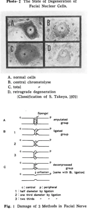 Fig. 1  Damage  of  3  Methods  in  Facial  Nerve    Trunk