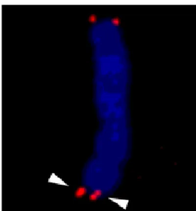 Fig. 4  Representative image of telomere fragility (arrowhead). 