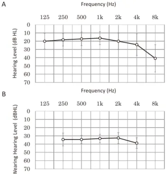 Fig. 1  Hearing level  （HL）  of NH group  （A）  and aided HL of CI  group  （B）.
