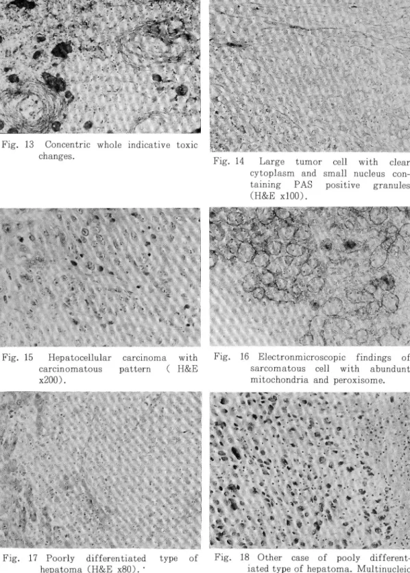 Fig. 13 Concentric whole indicative toxic changes.