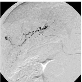 Fig. 4    Short-term therapeutic effect in 69-year-old man in the W group. 