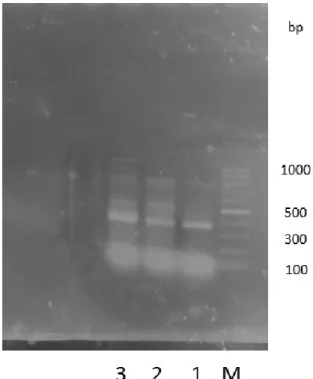Figure 2-2 E.coli C 株のゲノム DNA を鋳型にプライマー①、②を用いて 行った PCR 産物の 2 % アガロースゲル電気泳動
