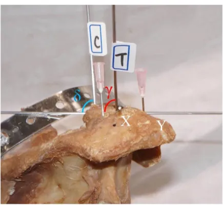 Fig. 1C. Lateral view of the right shoulder 
