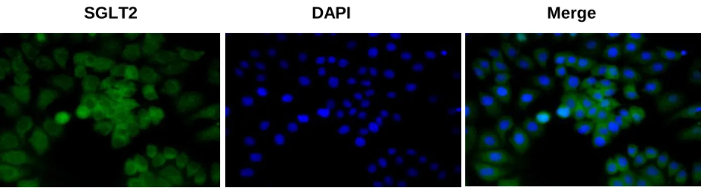 Figure 1 SGLT2 DAPI Merge SGLT2(94bp) TBP(170bp) MCF-7     MDA-MB231    KPL-1AB