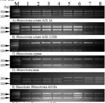 Fig. 1. Electrophoretic profiles of PCR-RFLP products digested by Hae III. 