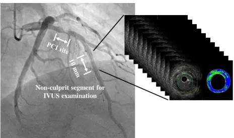 Figure 1. Representative IVUS measurement for the non-culprit segment