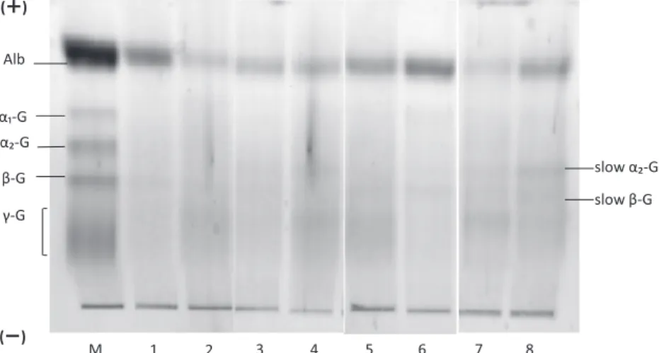 Fig. 1  Urinary protein fraction of patients with negative or (±) result of urinary protein test  paper using cellulose acetate membrane electrophoresis