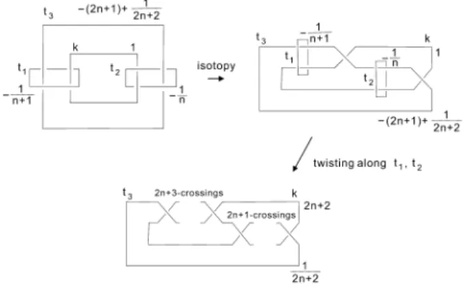 Figure 1: Surgery description of K n