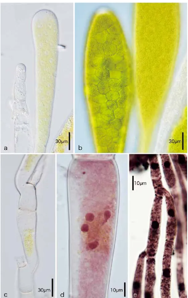 Fig. 3. Photographs showing Cladogonium sp. collected in Saga Prefecture. Early stage of maturation (a) and latter stage of maturation (b), chloroplasts or their traces in  a cell of erect portion (c), four nuclei in a cell of erect portion (d), single nuc
