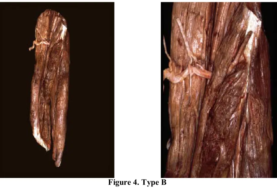 Figure 4. Type B 
