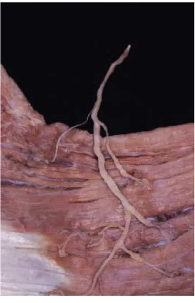 Figure 8. Branching Type 1