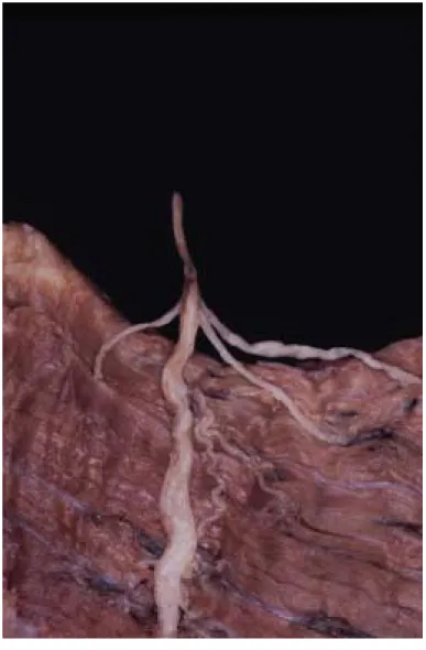 Figure 11. Branching Type 4 