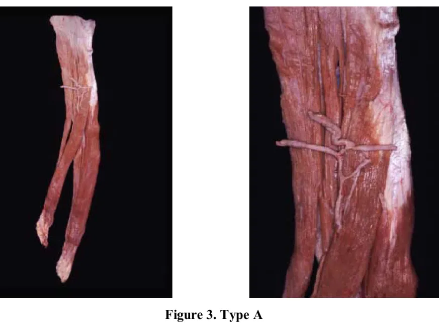 Figure 3. Type A 