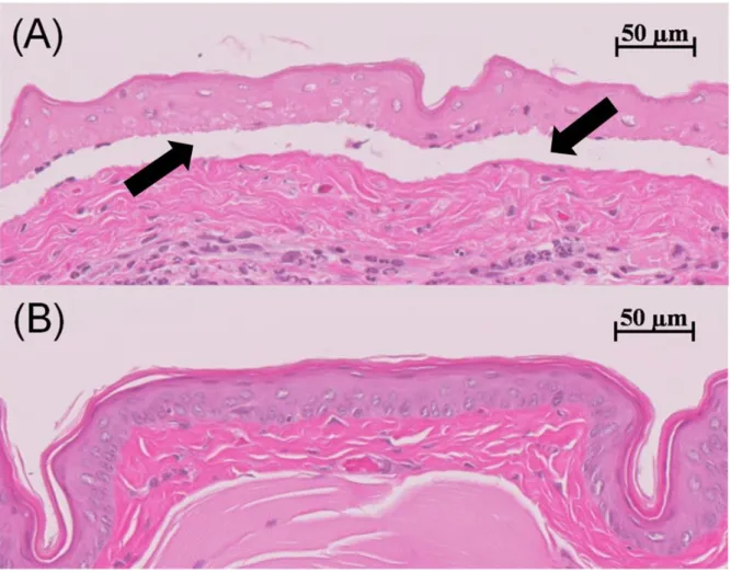 Fig. 1. An example of histological evaluation of hamster cheek pouch mucosa exposed to liquid of resin  as  positive  control  (A)  and  TiO 2 -coated  PMMA  (B)  was  exhibited