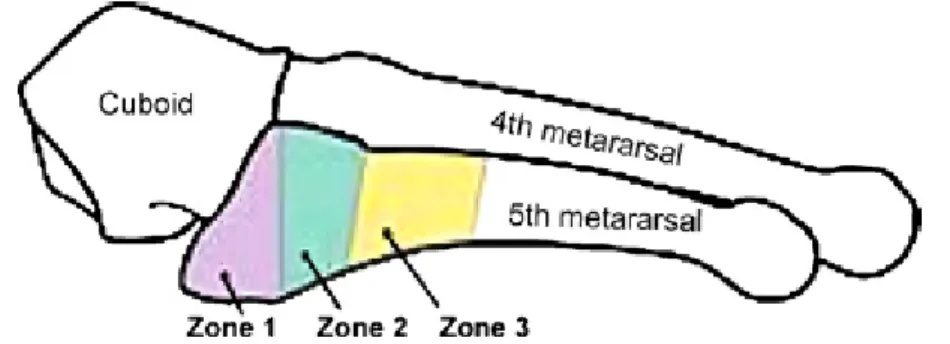 Figure 1-1．Classification in zones (Dameron, Lawrence and Quill)[34] 