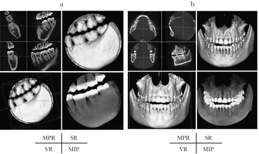 Fig. 2 Two alternative FOVs for selected mode, D-mode (a) and I-mode (b)
