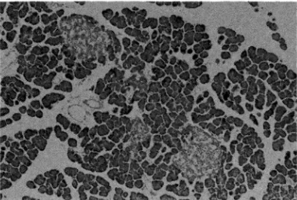 Fig.  5  Electron  micrograph  of  B  cells  at  2nd