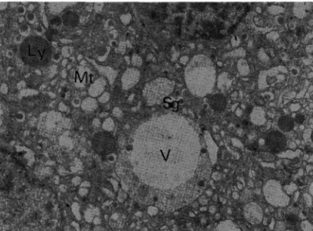 Fig.  10  Electron  micrograph  of  A  cells  at  the  4th weeks  after  ligation.  (•~25,000)