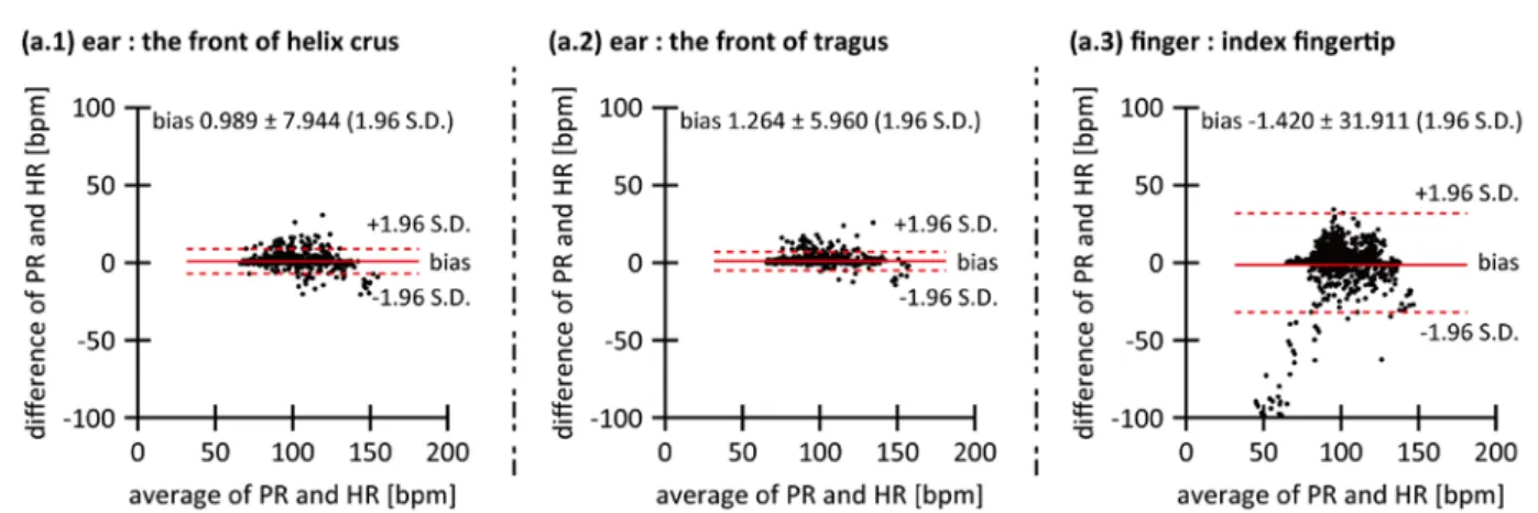 Fig. 4. Bland-Altman  plots; HR derived from ECG and PR derived from PPG on the ear and finger using  green light (top; a.1, a.2, a.3) and NIR light (bottom; b.1, b.2, b.3) 