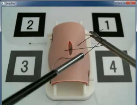 Fig. 9 Camera image of skilled surgeon's forceps operation 