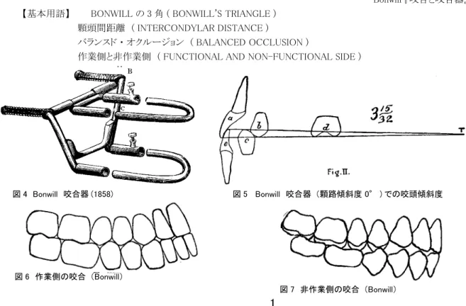 図 4　Bonwill　咬合器 (1858)  図 5   Bonwill　咬合器 （顆路傾斜度 0° ) での咬頭傾斜度