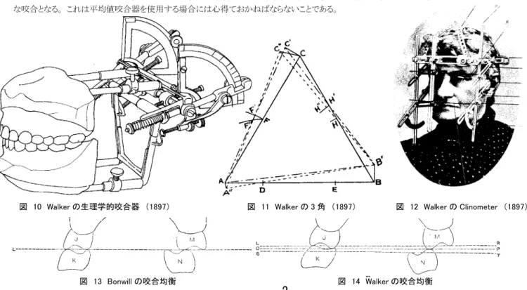 図　10　Walker の生理学的咬合器　（1897）  図　11　Walker の 3 角　（1897）  図　12　Walker の Clinometer　（1897） 