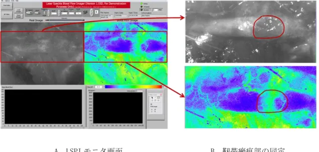 図 3  LSPI による生体内血流測定 