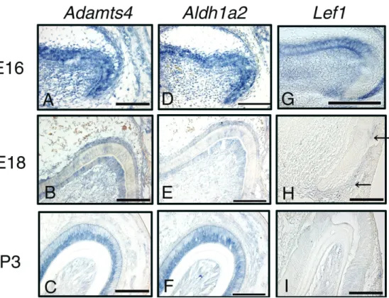 Figure 2.  Expression of Adamts4, Aldh1a2, and Lef1 during tooth development (E16, E18, and P3) in  mouse tooth germs