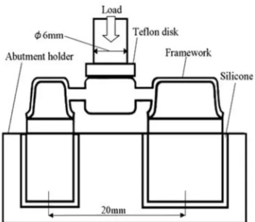 Fig. 2 Test device for determination of static load bearing of 3-unit framework