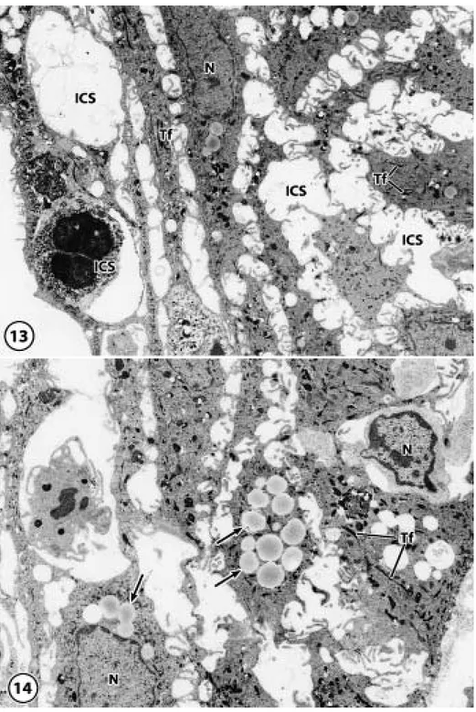 Fig. 13 In the cytoplasm of cells in the peri-implant epithelium, a number of tonofilaments were observed diffusely with a few mitochondria and endoplasmic reticula